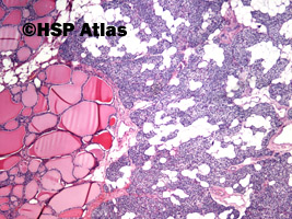 1. Parathyroid gland histology, 4x