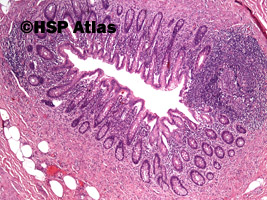 2. Appendix - histology, 4x