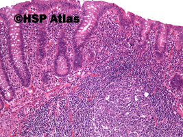 4. Appendix - histology, 10x