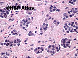 14. Rakowiak [carcinoid - well differnetiated neuroendocrine tumor/neoplasm (NET)], 40x