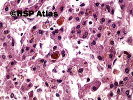 3. Zastój żółci (cholestasis of liver), 40x