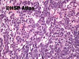 7. Wątrobiak zarodkowy (hepatoblastoma), 20x
