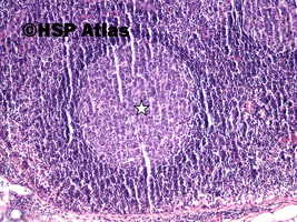 2. Secondary follicle with germinal center (white arrow), 10x