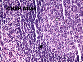 3. Secondary follicle with germinal center (white arrow) and mantle zone (black arrow), 20x