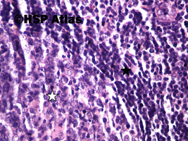 4. Secondary follicle - germinal center (white arrow) with mantle zone (black arrow), 40x