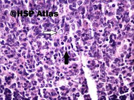 6. Centrocyty (czarna strzałka), komórki dendrytyczne (biała strzałka), 40x