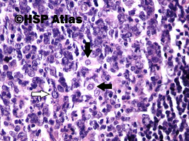 8. Komórki dendrytyczne (czarne strzałki), centroblast (biała strzałka), 40x