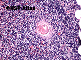2. Grasica - ciałko Hassala (thymus - Hassall's corpuscles), 20x