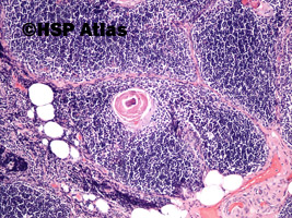 3. Grasica - ciałko Hassala (thymus - Hassall's corpuscles), x10