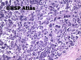 8. Leydig cell tumor, 20x